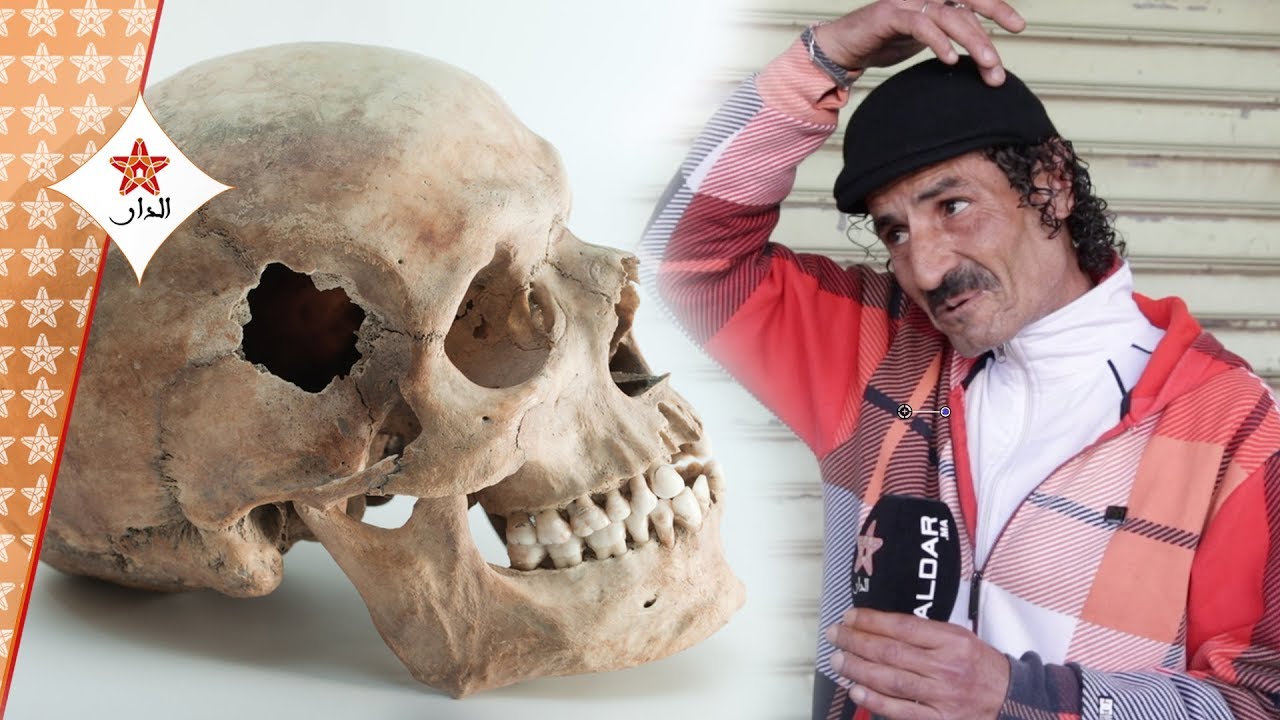 حصري.. خطير: هذا هو الشخص الذي عرض عليه شراء رأس جثة آدمية بتمارة