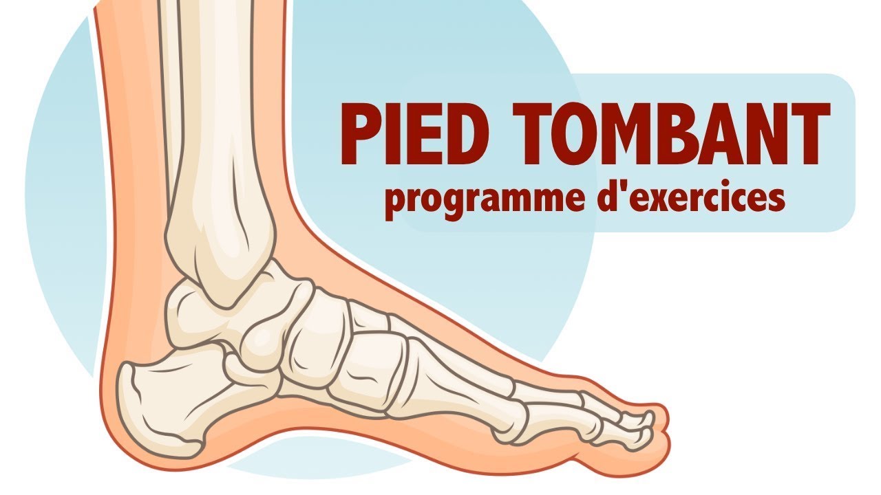 Pied tombant : exercices à faire à la maison, niv. avancé