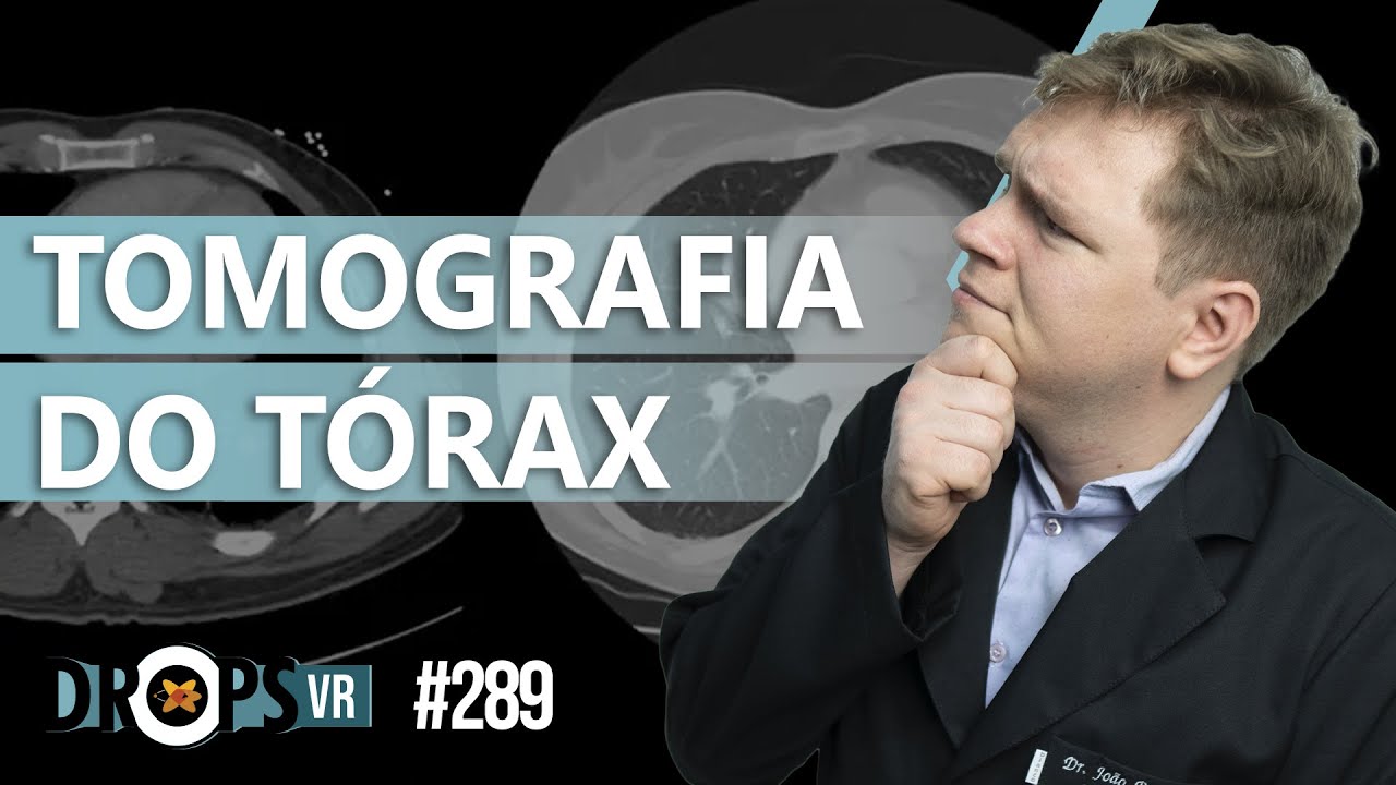 TOMOGRAFIA DO T&Oacute;RAX - SAIBA O B&Aacute;SICO!