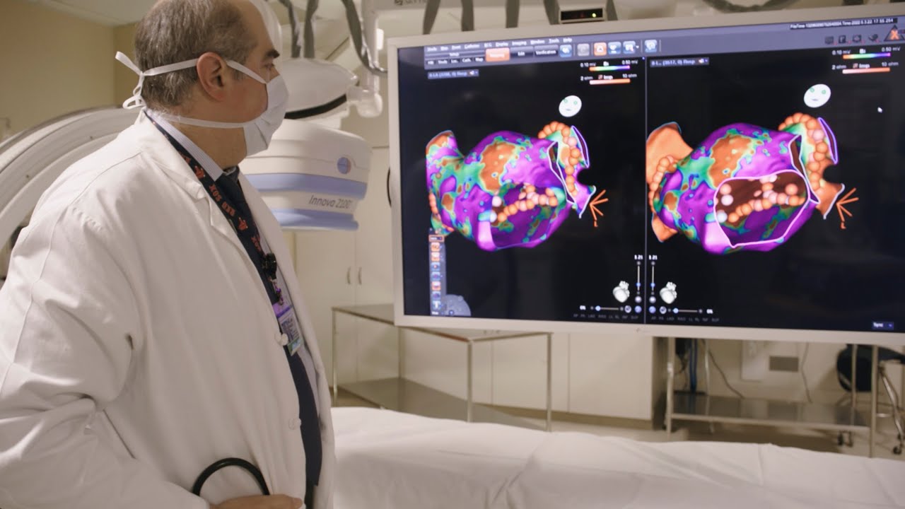 Фибрилляция предсердий и катетерная абляция | NEJM