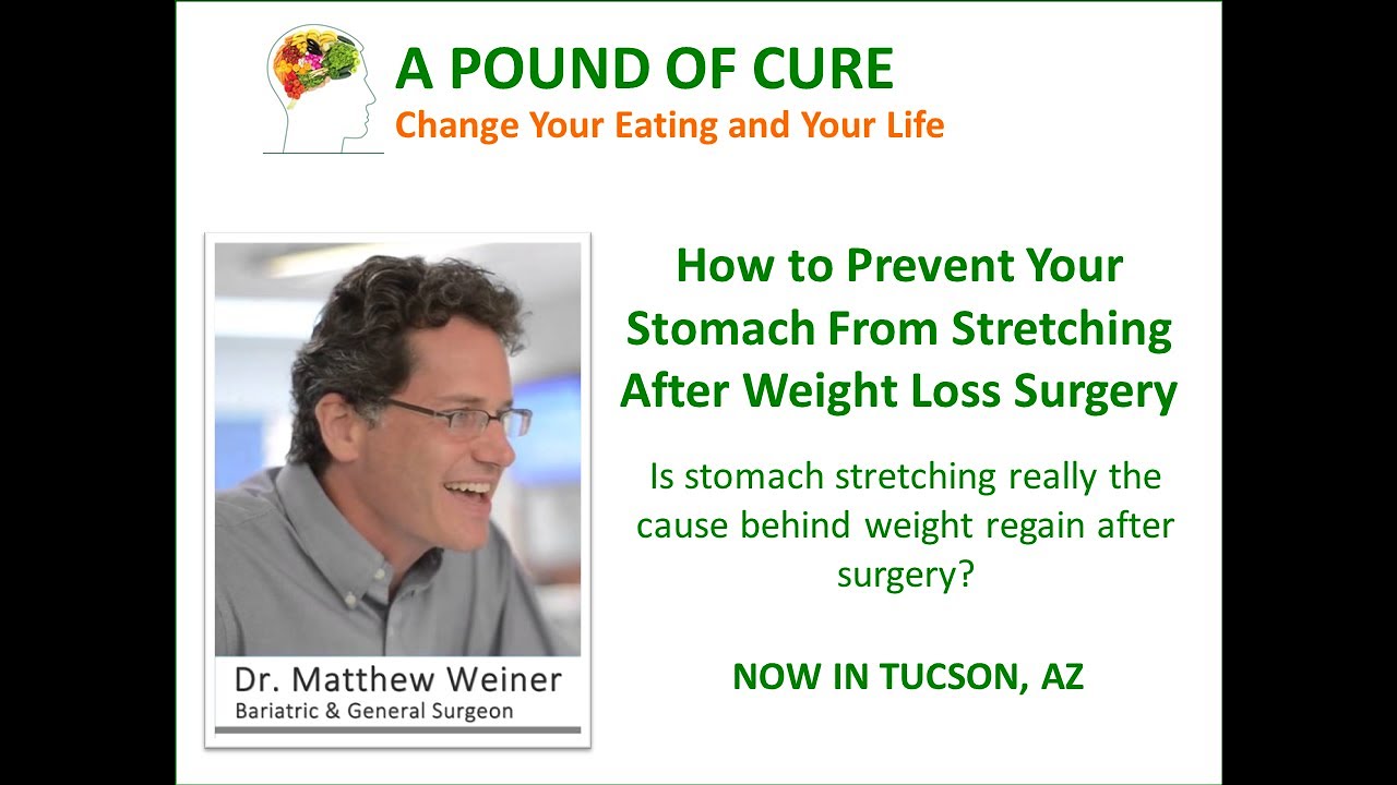 How to prevent your stomach from stretching after weight loss surgery