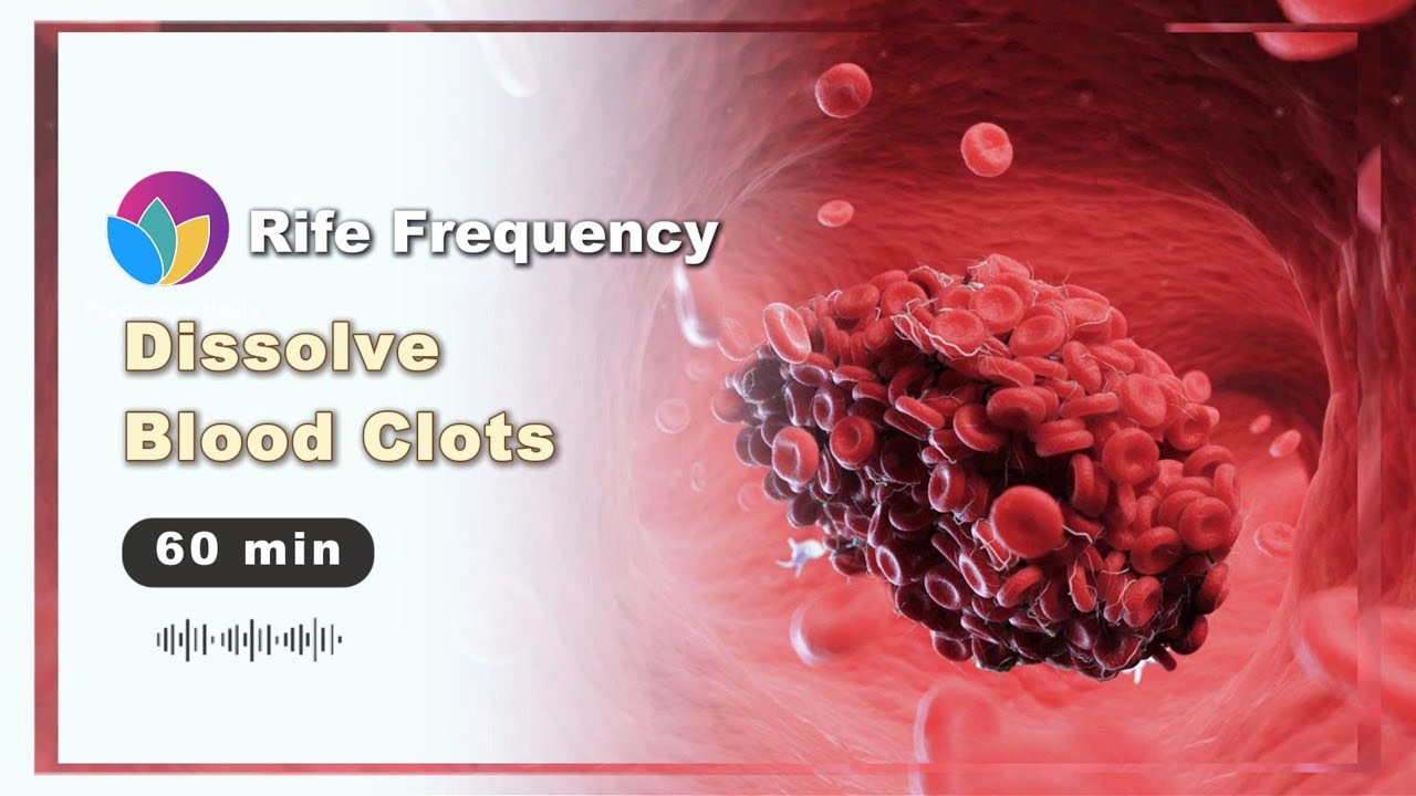 Assist Blood Flow & Reduce Clots | Thrombosis Support Rife Freq: Improve Blood Circulation Naturally
