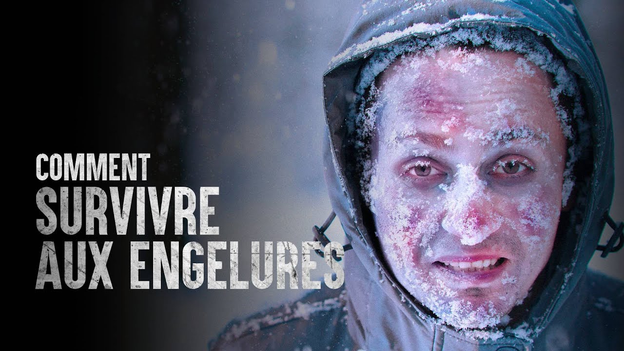 Comment survivre aux engelures