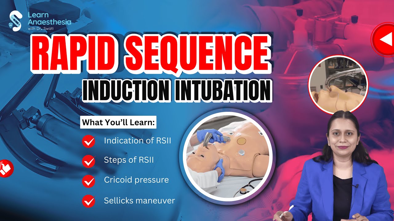 RSII Step-by-Step: Indications, Technique & Sellick&rsquo;s Maneuver Explained | Anesthesia Residency