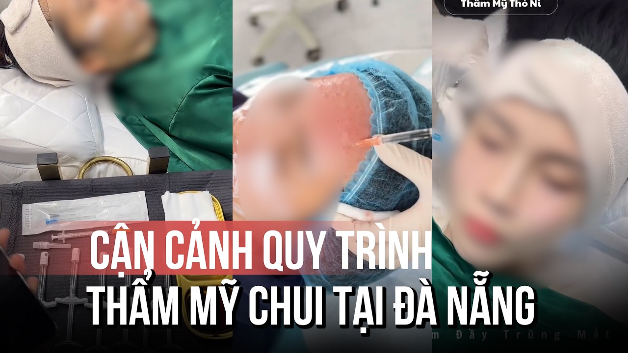 Thẩm mỹ chui bủa vây: Cận cảnh quy trình làm đẹp không phép tại Đà Nẵng
