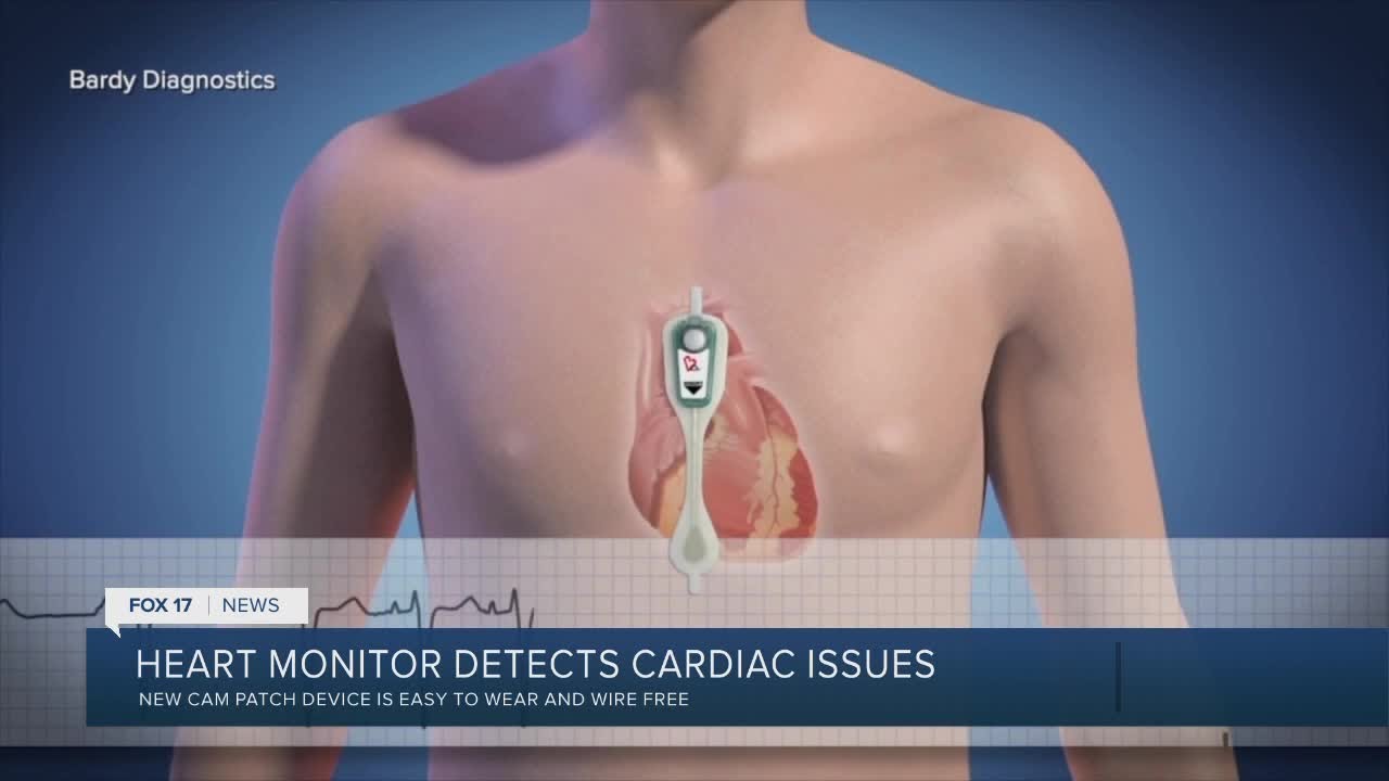 New Heart Monitor Technology