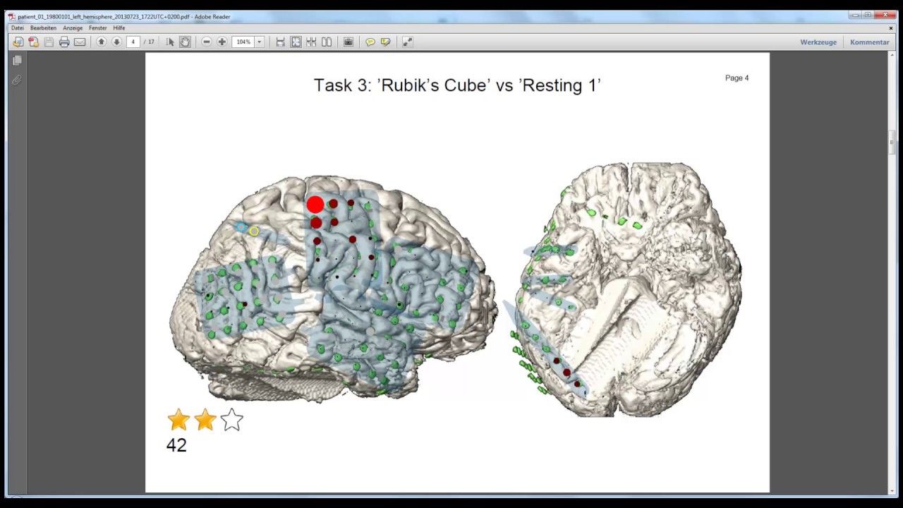 cortiQ - rapid cortical mapping [extended]