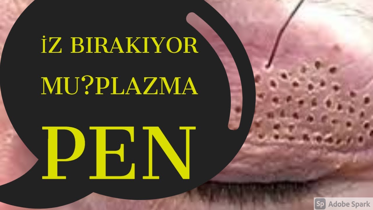 PLAZMA PEN İZ BIRAKIYOR MU? (Uygulama öncesi izle)