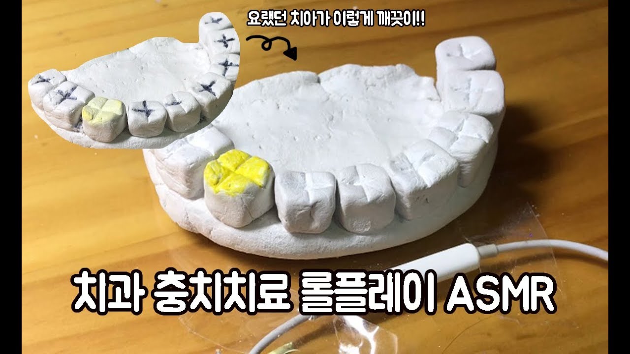 이가 많이 썩으셨네요~ 치과 충치치료 롤플레이 ASMR｜학생asmr