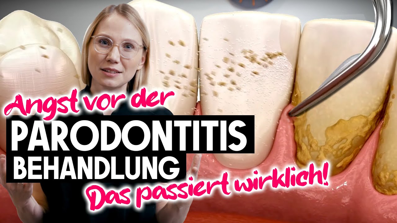 Behandlung unter dem Zahnflleisch! 50% der Bev&ouml;lkerung werden diese Erfahrung machen | Parodontitis