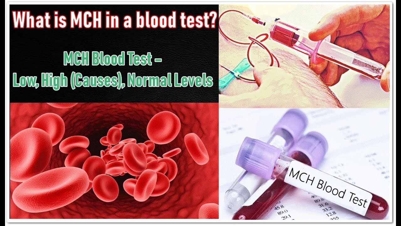 MCH Blood Test &ndash; Low, High (Causes), Normal Levels