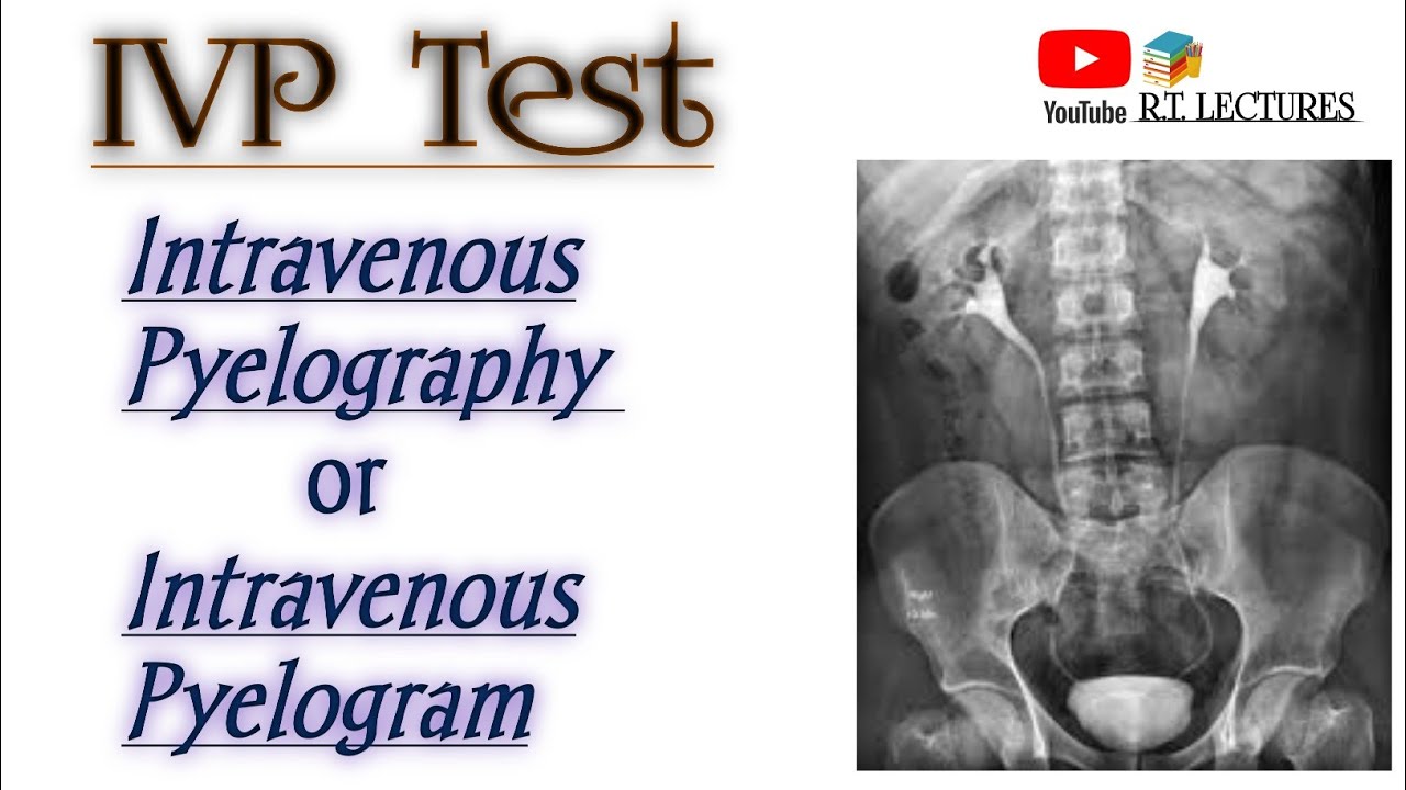 #IVP test(Intravenous Pyelography) #IVU(Intravenous Urography)test #Excretoru Urography test complte