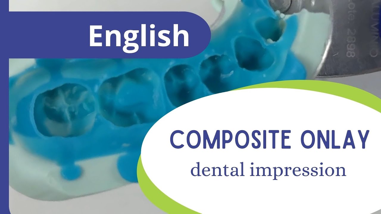 Composite onlay - part 2: dental impression.