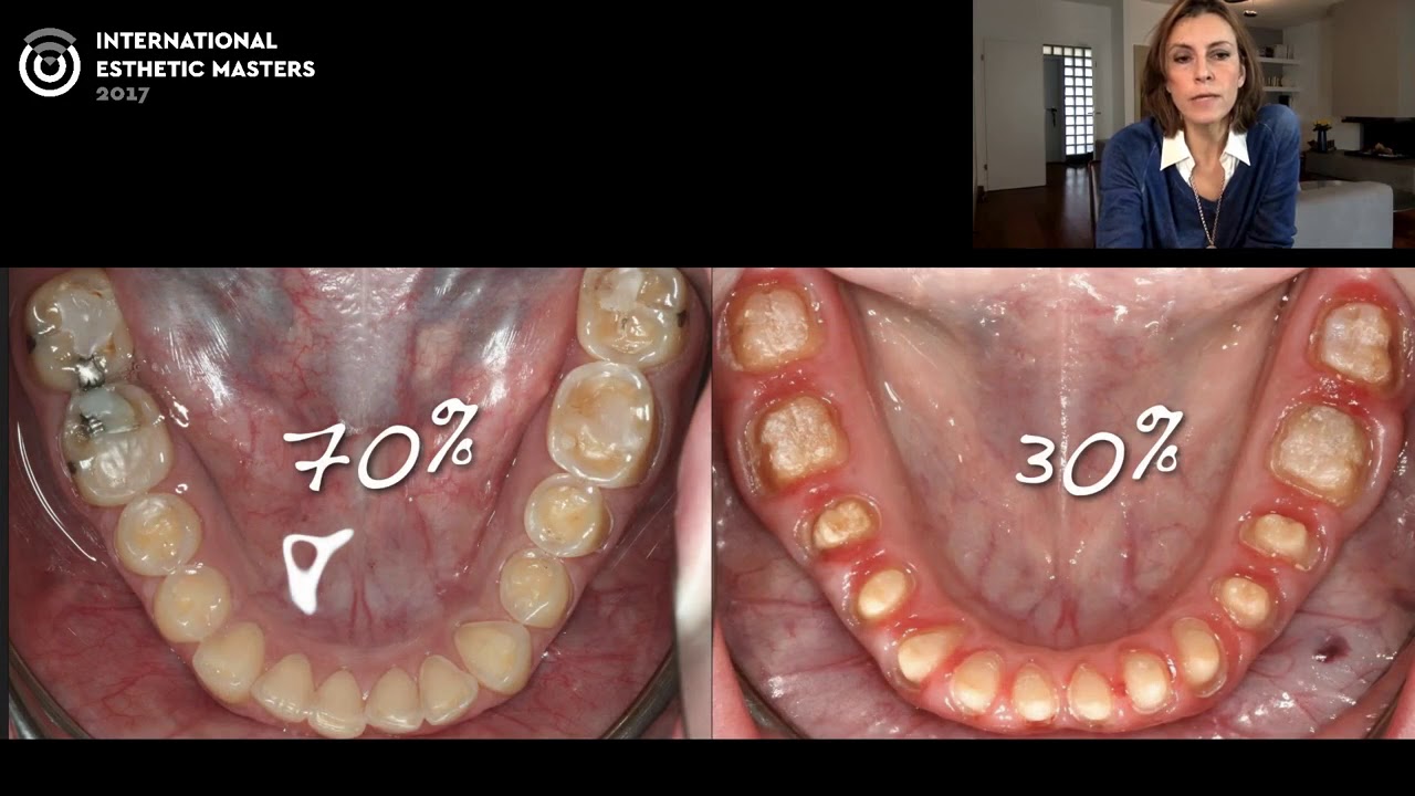 3 Step Technique And The Additive Approach