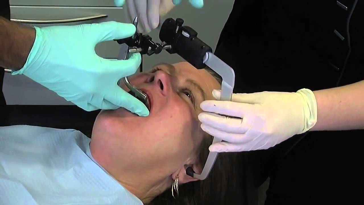 Smile make over with Dr  Parmar  Episode 6  denar face bow