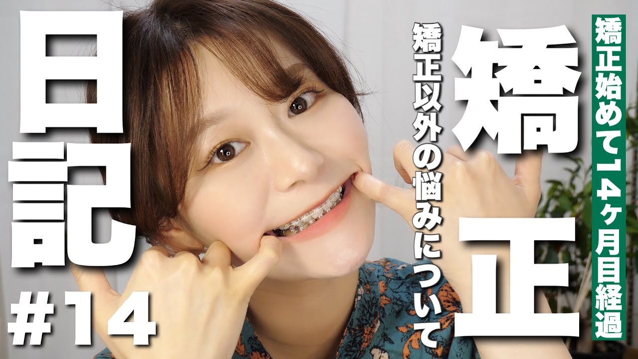 【矯正日記#14】14ヶ月目で感じた矯正以外の悩み(たるみや顎...etc)経過、矯正Q&A by 桃桃