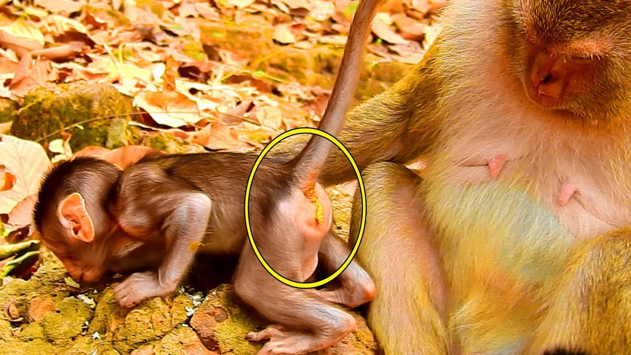 It Often Happens To Baby Bronx Buttock Like That, It Look Baby Get Diarrhea