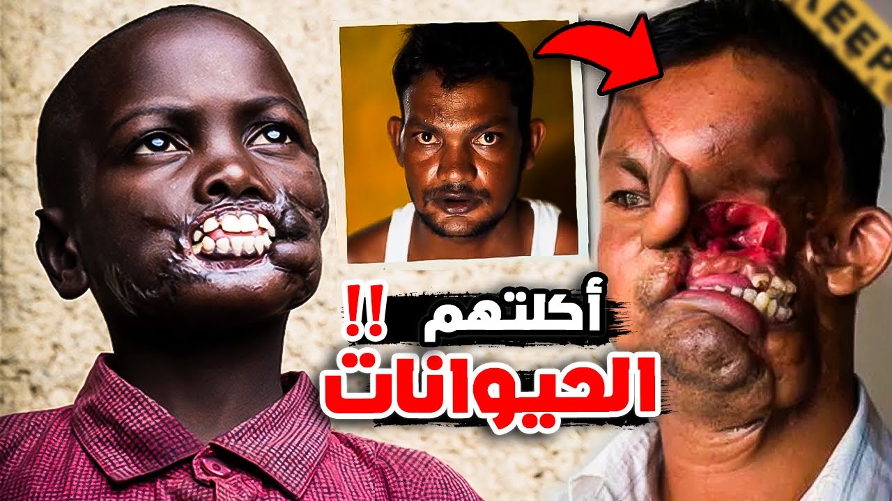 أشخاص نجوا من هجوم الحيوانات المفترسة !!