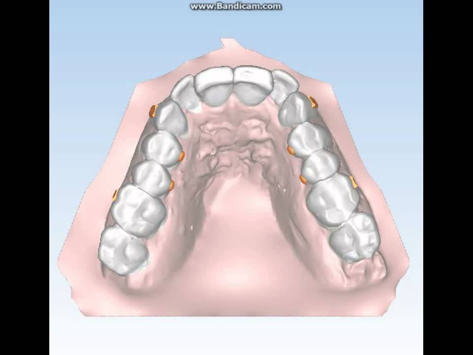 Ortodonzia Invisibile Aurodental 8