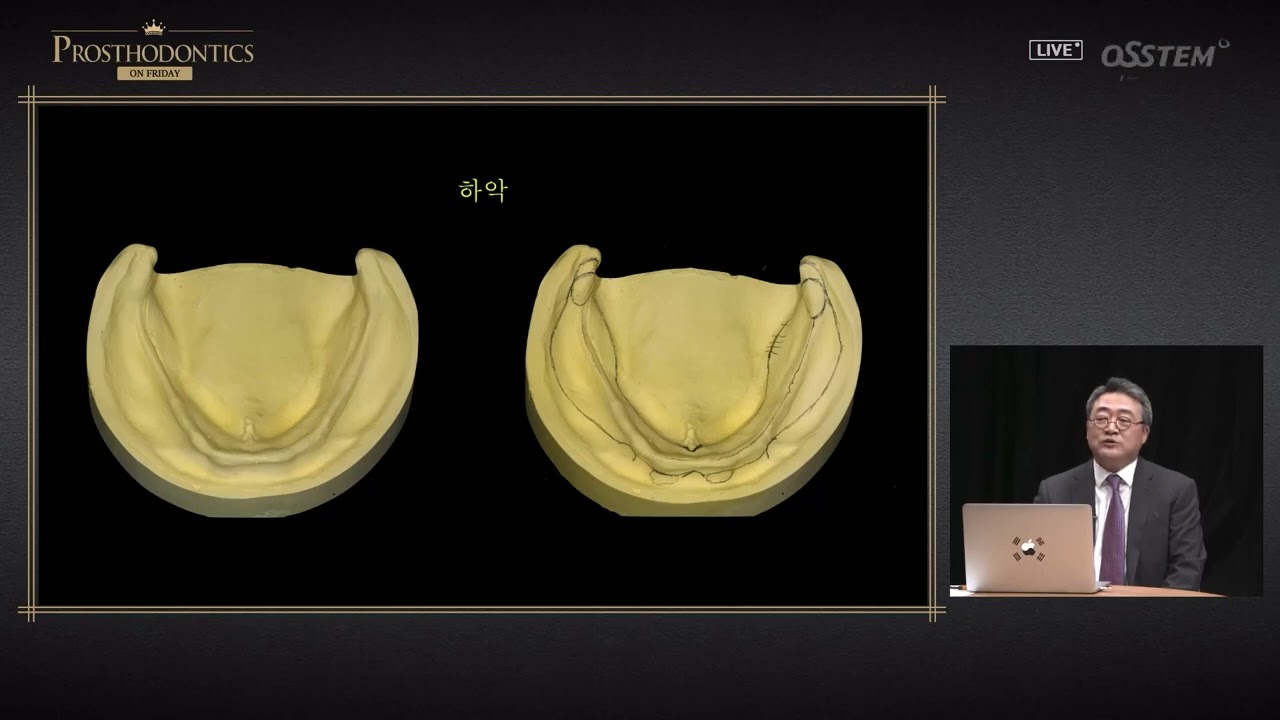 PROSTHODONTICS ON FRIDAY