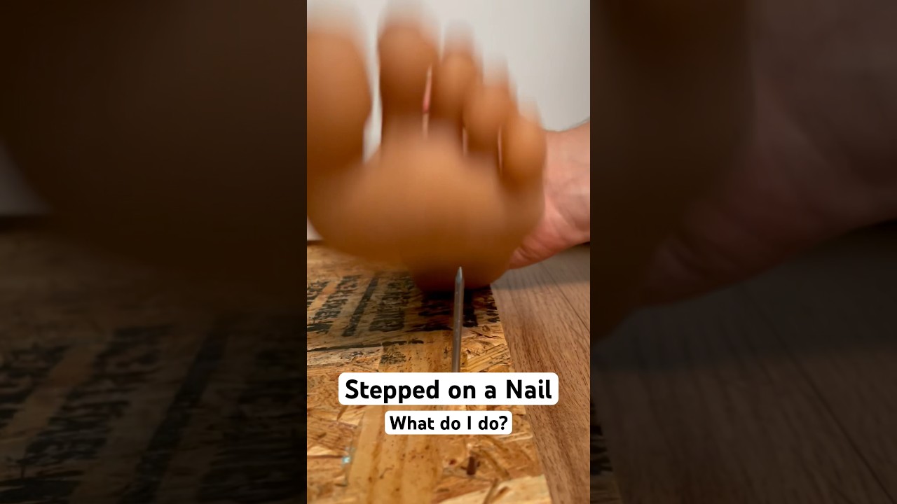 Stepped on a nail? Try this&hellip; #survival #health #medical