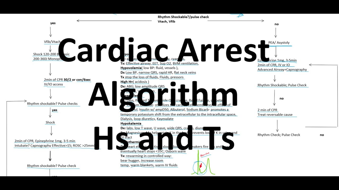 Cardiac Arrest and Hs and Ts