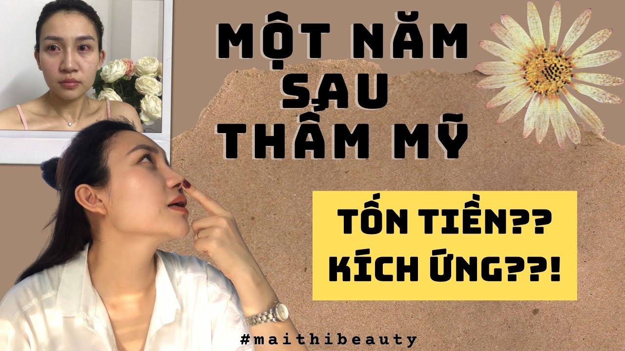 T&acirc;m sự sau một năm thẩm mỹ | Mở g&oacute;c mắt c&oacute; an to&agrave;n kh&ocirc;ng?