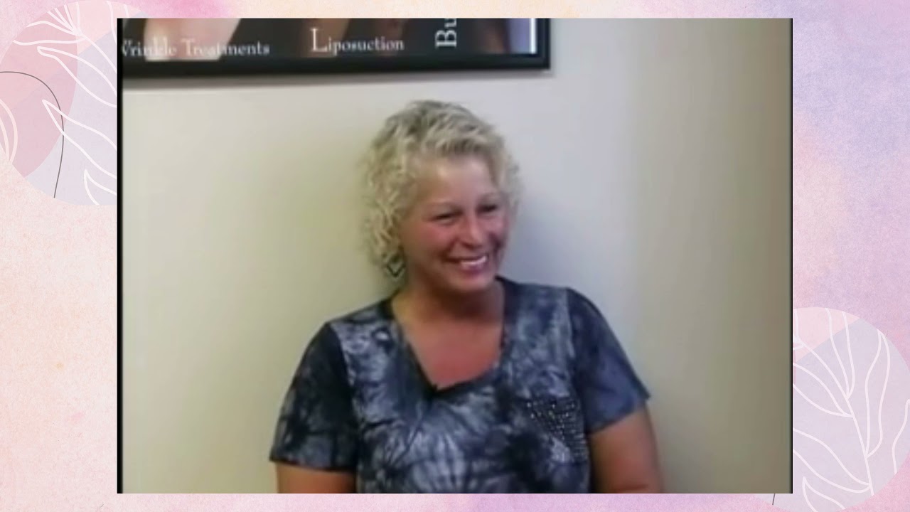 Patient testimonial ShapeMed4u Dr.Katsaros
