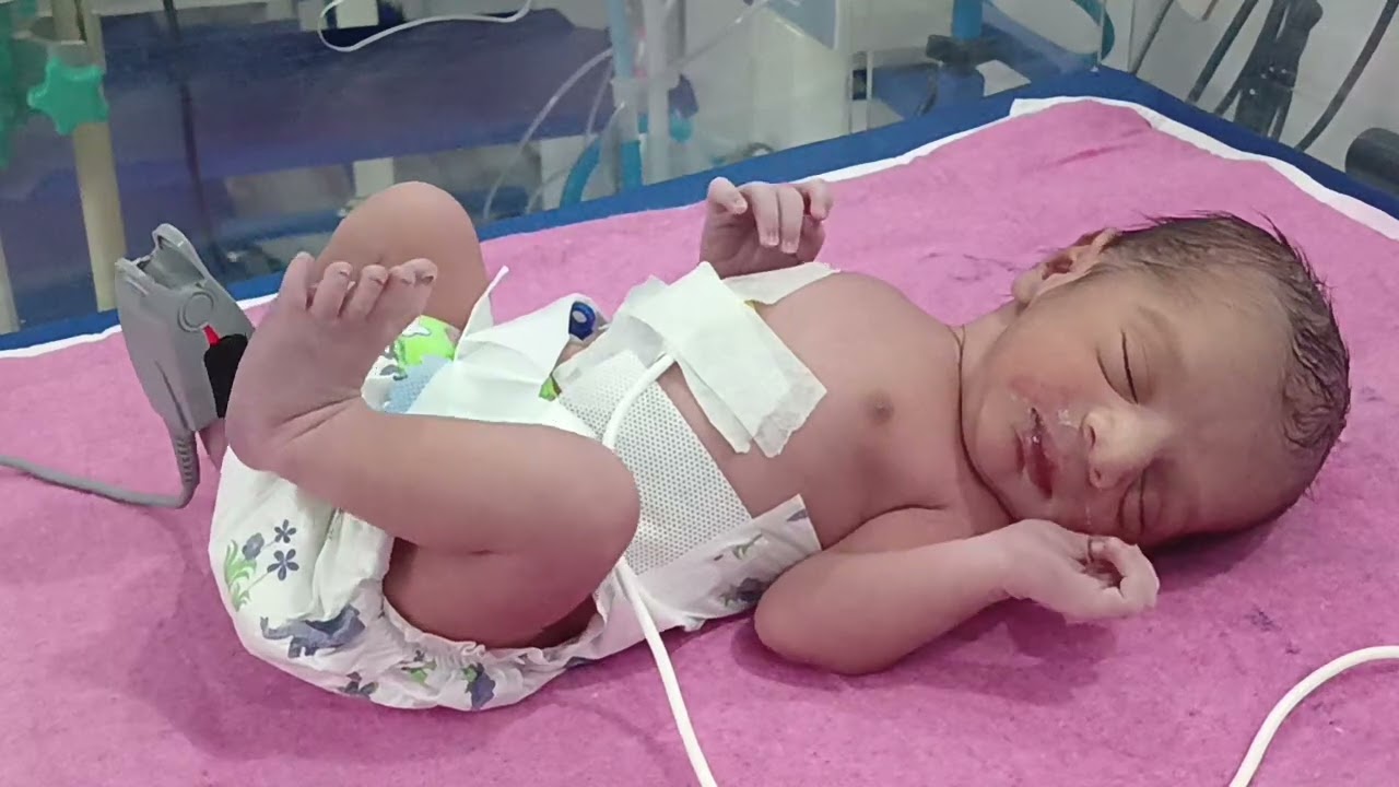 Cute New Born Adorable Baby 🤩 || Reaction After birth 😍♥️ #baby #newborn 