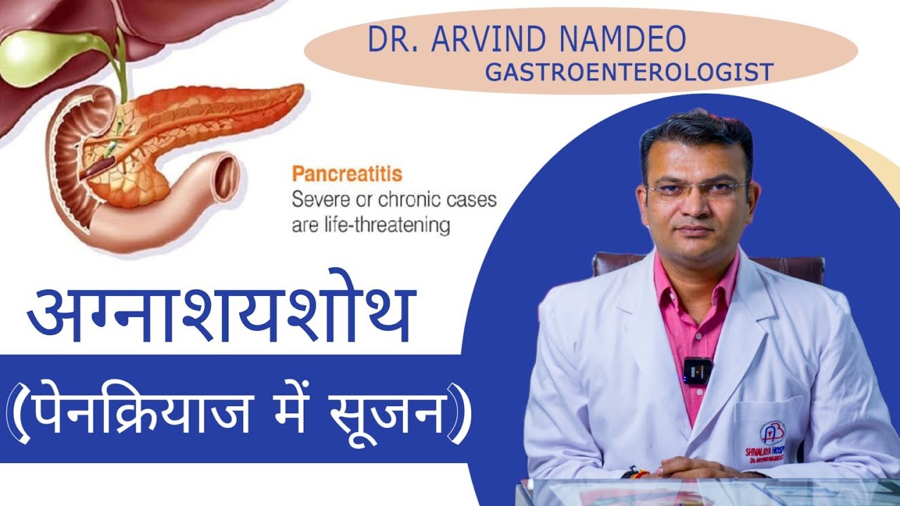 अग्नाशय में सूजन का इलाज | What is the most common treatment for pancreatitis ? | Dr Arvind Namdeo