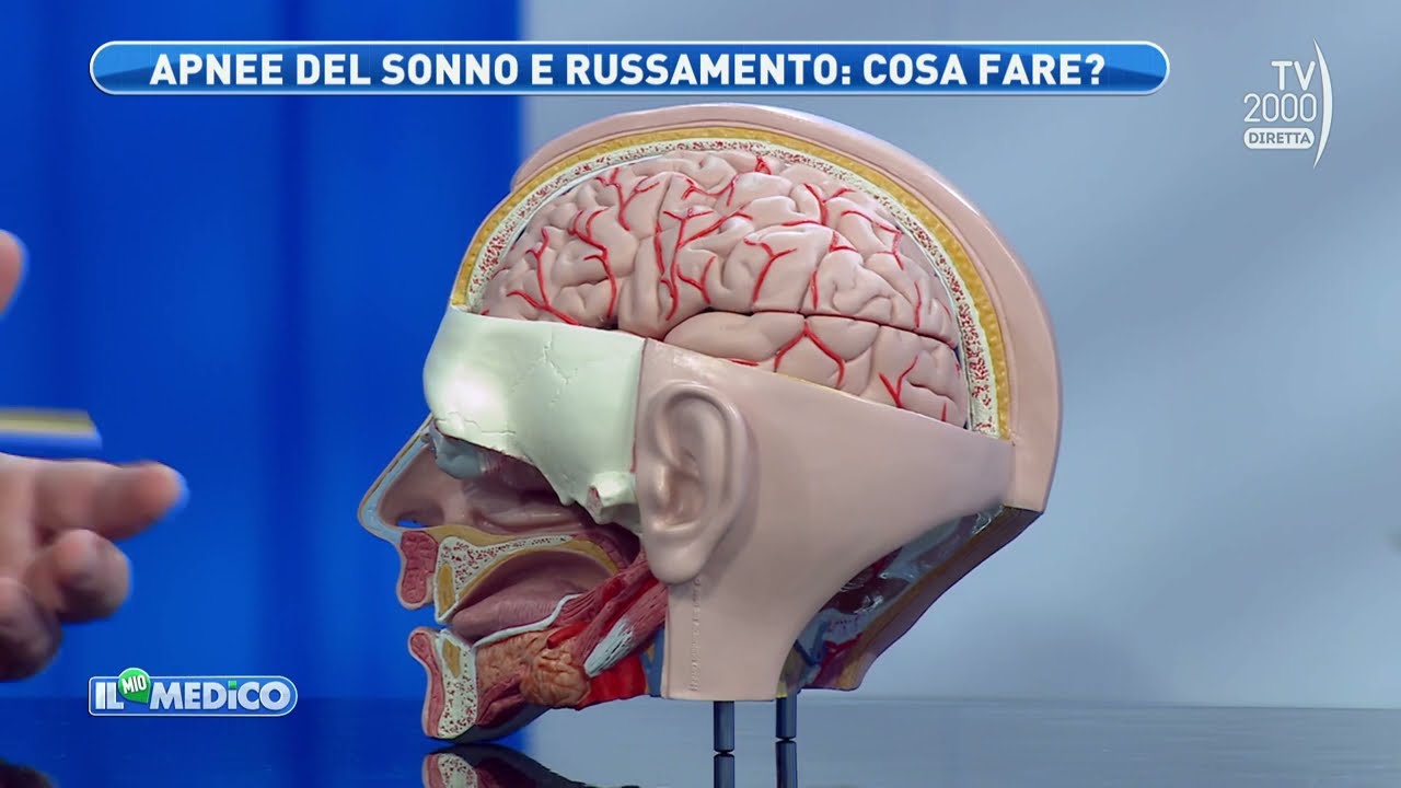 Il Mio Medico (Tv2000) - Tecniche all&rsquo;avanguardia per curare le apnee notturne