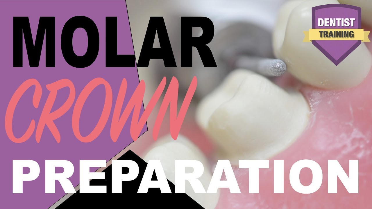 Molar Crown Preparation | Dental Crown Techniques