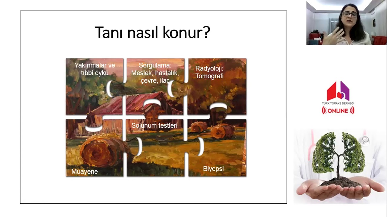 Akciğer sertleşmesi nedir? Tehlikeli midir?