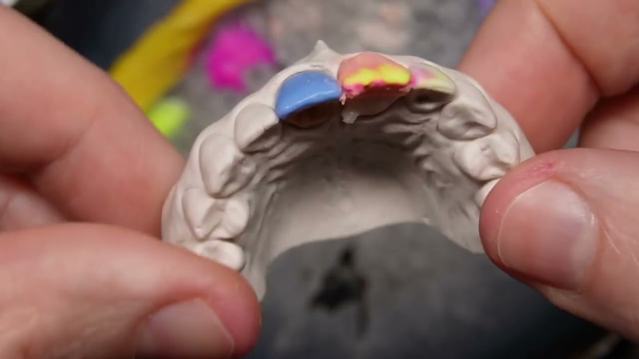 Цирконий этапы изготовления