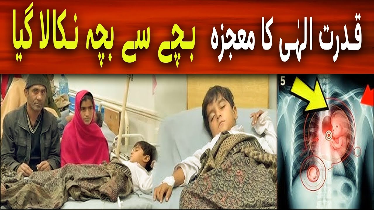 Unbelievable Case: Fetus in Fetu Surgery in Rahim Yar Khan