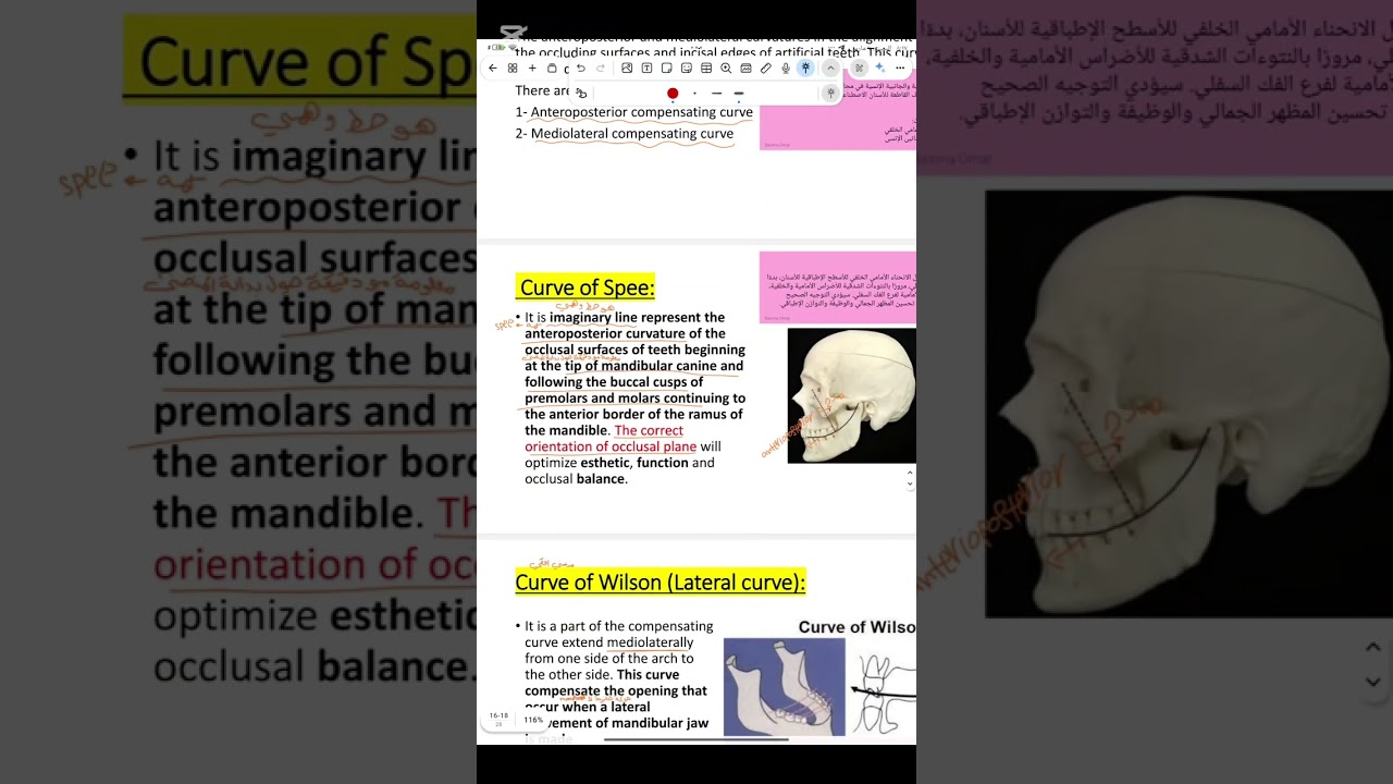 Prosthodontics lec 15طب الاسنان مرحله ثانيه 