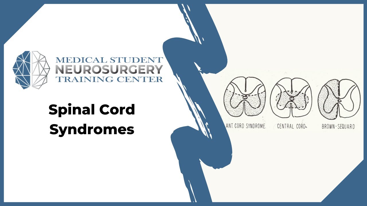 Spinal Cord Syndromes