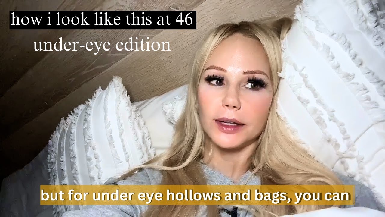 literally everything you need to know about UNDER EYE AGING (eye bags & hollows)