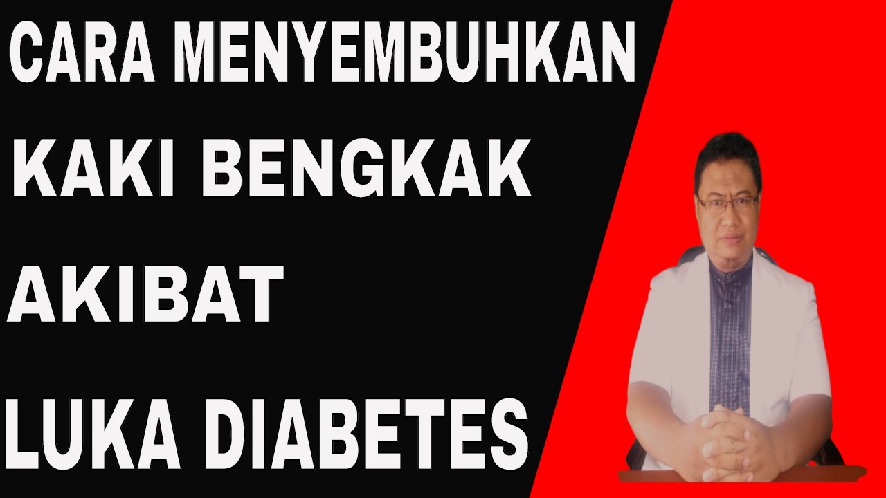 Penyebab kaki bengkak pada penderita luka kaki diabetes dan cara menyembuhkannya.