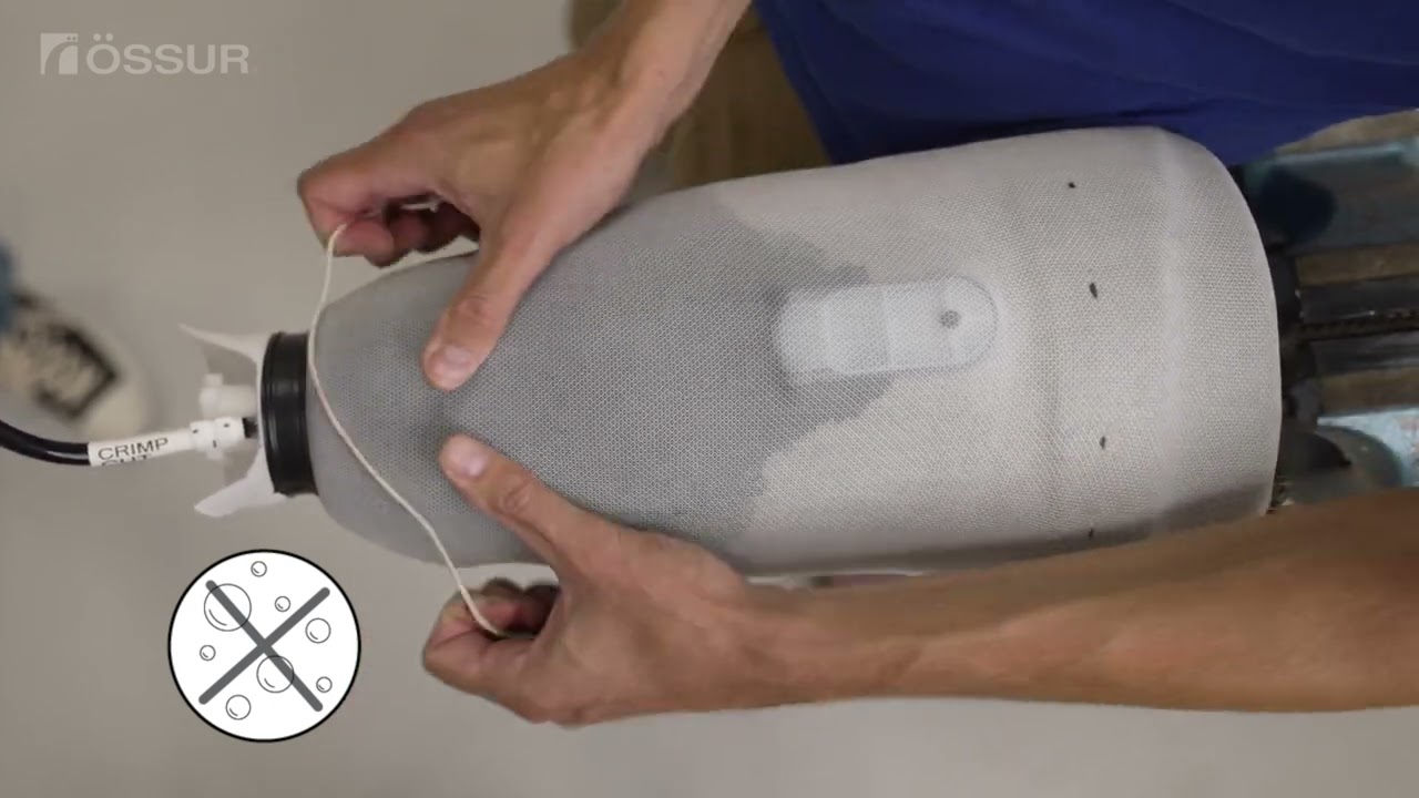 Icelock 850 Hybrid - Direct Socket (Clinician Fabrication Tutorial)