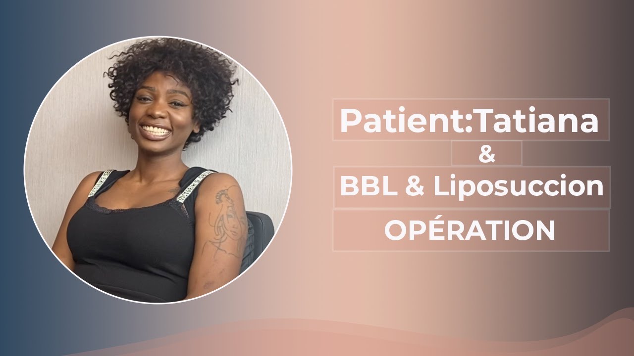 Tatiana / Liposuccion BBL OPÉRATION