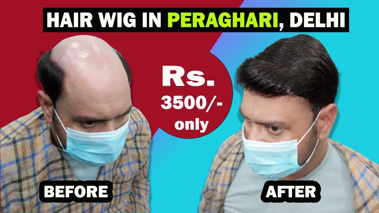 Hair Wig Peraghari Delhi | Hair Patch Peraghari Delhi | Hair Fixing Peraghari Delhi | Wigs Peraghari