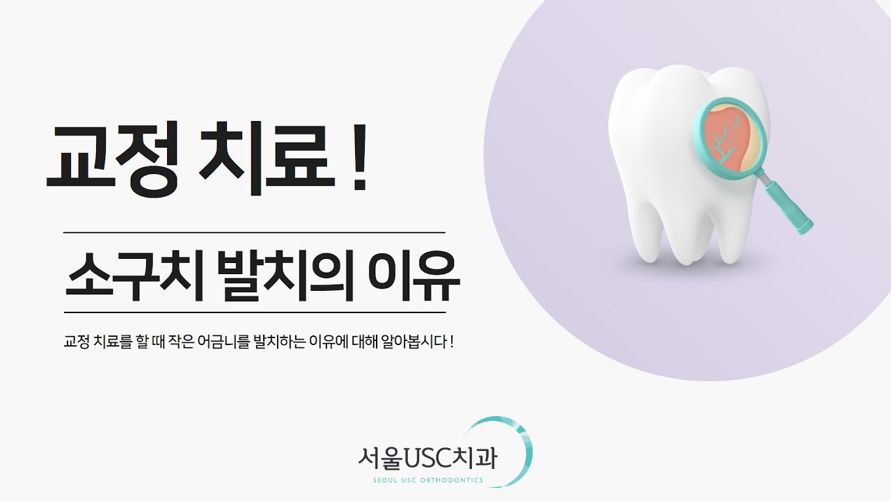 교정 치료할 때 치아를 발치하는 이유는 ? 소구치발치 이유
