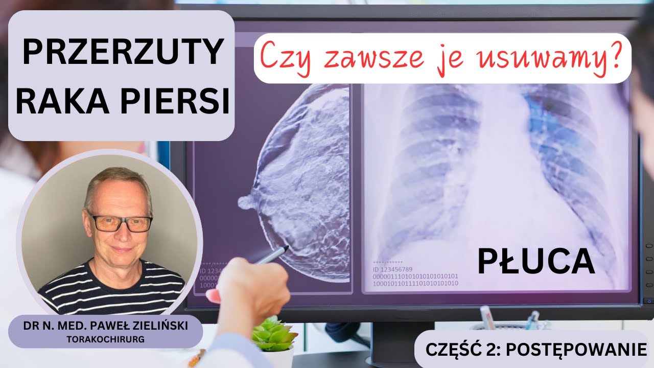 Odcinek 148. Czy zawsze usuwamy przerzuty raka piersi do płuc?