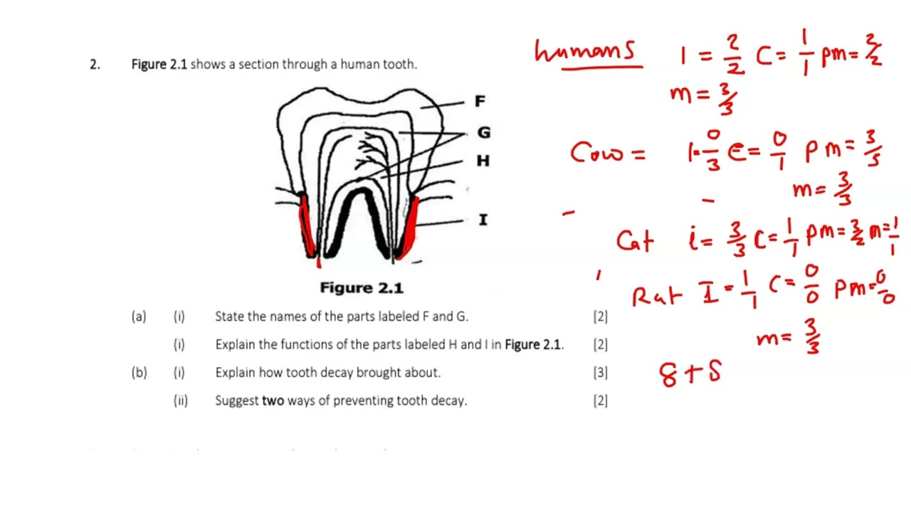 Dentition || exam questions|| Topic summarized