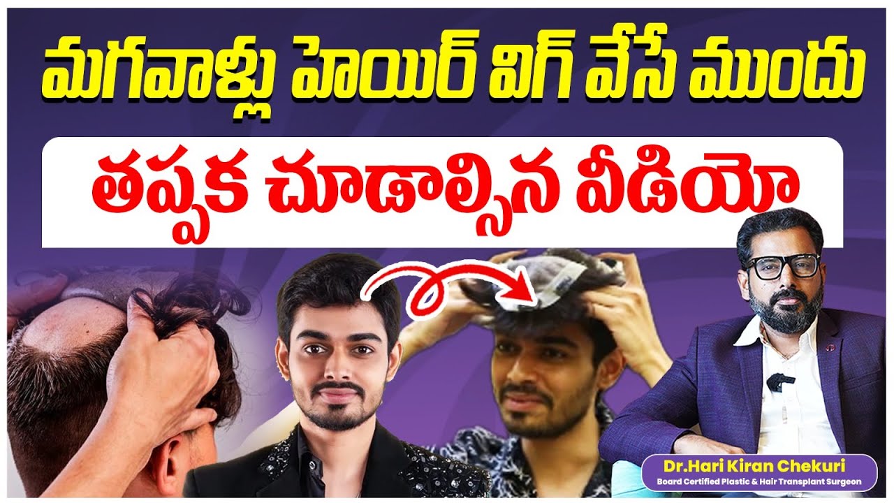 Are Hair Wigs Safe for Men? Pros & Cons You Must Know || Hair Wigs for Men || ReDefine Channel