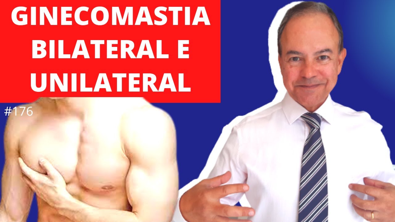 O que é Ginecomastia unilateral e bilateral? [Dr. Jacintho - Cirurgião Plástico]