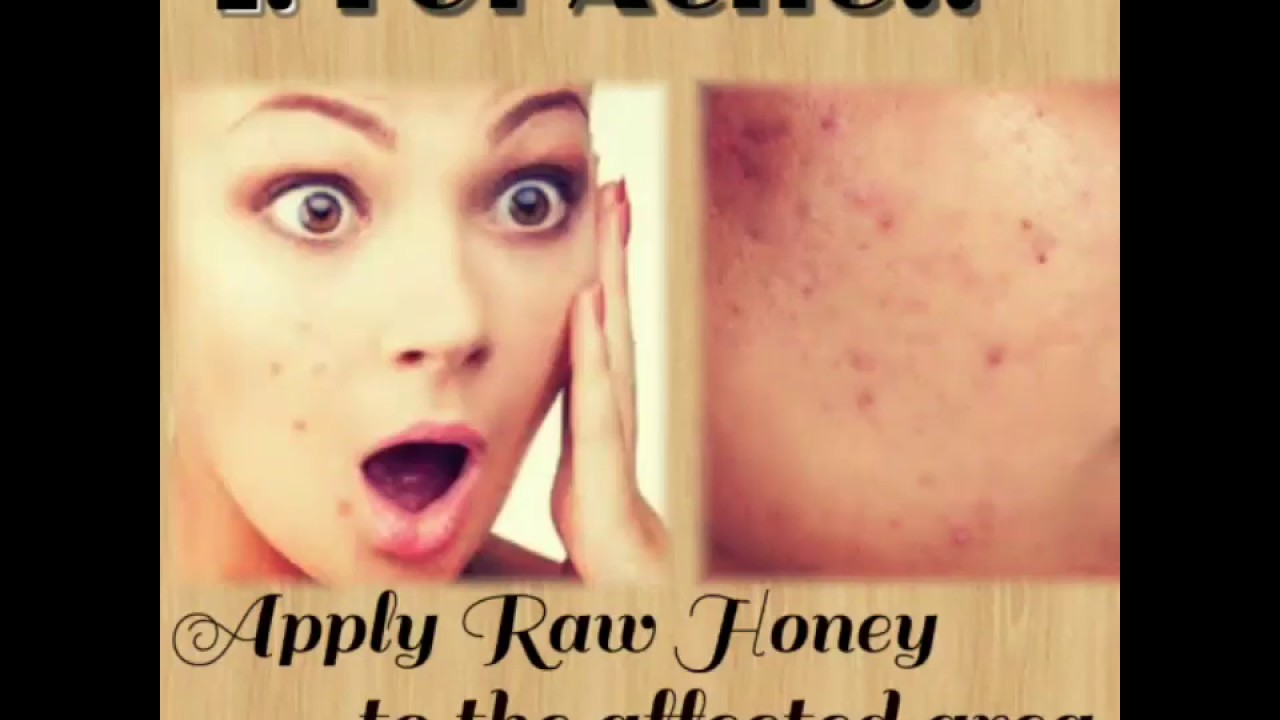 Overnight Beauty Tips with honey💖|Now Cure Pimple ,Blackheads Faster|Tried and Tested👈👍👍