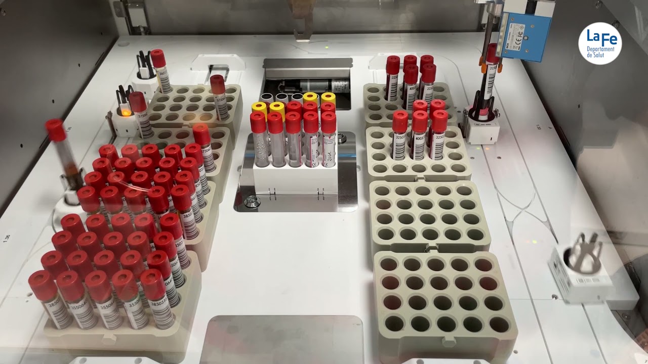 El Hospital La Fe incorpora un nuevo sistema de robotización inteligente en el Laboratorio