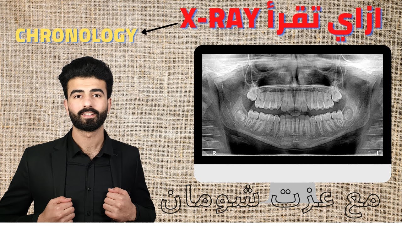 كيف تحدد عمر المريض من خلال ال x ray || chronology || dental anatomy